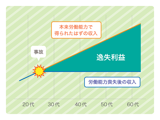 逸失利益とは
