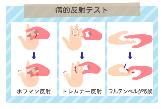 病的反射テスト